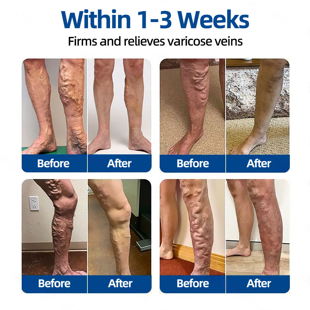 ✅𝐅𝐃𝐀 𝐑𝐞𝐠𝐢𝐬𝐭𝐞𝐫𝐞𝐝 & 𝐆𝐌𝐏 𝐂𝐞𝐫𝐭𝐢𝐟𝐢𝐞𝐝 |𝐅𝐥𝐨𝐫𝐢𝐬𝐦𝐚® 𝐕𝐞𝐢𝐧𝐓𝐚𝐫𝐠𝐞𝐭 𝐌𝐢𝐜𝐫𝐨𝐧𝐞𝐞𝐝𝐥𝐞 𝐏𝐚𝐭𝐜𝐡⚡（UPSELL）