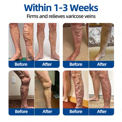 ✅𝐅𝐃𝐀 𝐑𝐞𝐠𝐢𝐬𝐭𝐞𝐫𝐞𝐝 & 𝐆𝐌𝐏 𝐂𝐞𝐫𝐭𝐢𝐟𝐢𝐞𝐝 |𝐅𝐥𝐨𝐫𝐢𝐬𝐦𝐚® 𝐕𝐞𝐢𝐧𝐓𝐚𝐫𝐠𝐞𝐭 𝐌𝐢𝐜𝐫𝐨𝐧𝐞𝐞𝐝𝐥𝐞 𝐏𝐚𝐭𝐜𝐡⚡（UPSELL）