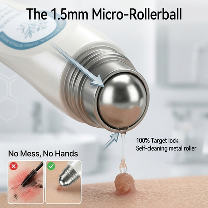 𝐏i𝐜𝐝o® 🌿💖7-𝐷𝑎𝑦 𝗧𝐚𝐠 & 𝗦𝗽𝐨𝐭 𝐄𝐫𝒂𝒔𝒆𝒓(Zero Pain, Zero 𝐒𝐜𝐚𝒓𝒔 Rollerball)
